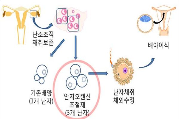 서울대병원 구승엽 교수팀이 실험에 성공한 복수난자 배양법 흐름