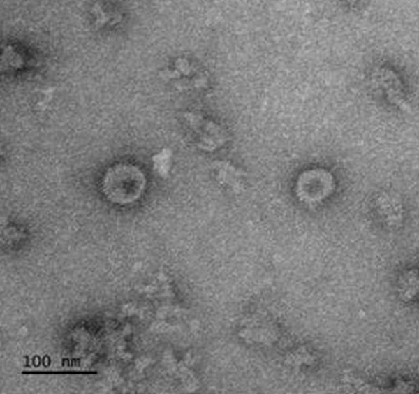 코로나19 바이러스항원(Spike)으로 구성된 바이러스유사체 투과전자현미경(TEM) 이미지